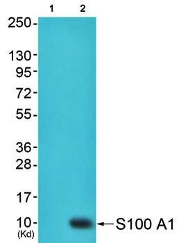 S100A1 antibody