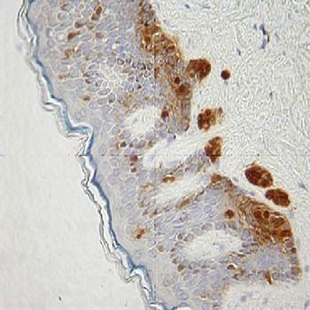 S-100 beta Antibody
