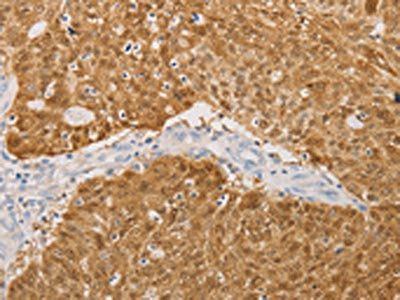 S100A1 Antibody