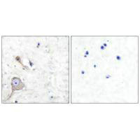 S100A1 antibody