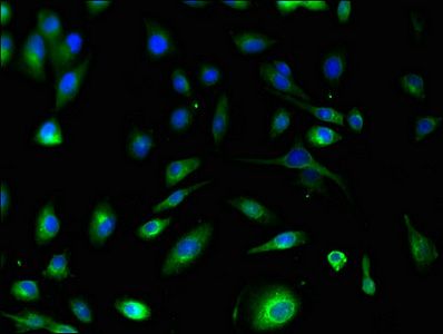 S100A10 Antibody