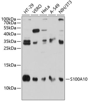 S100A10 antibody