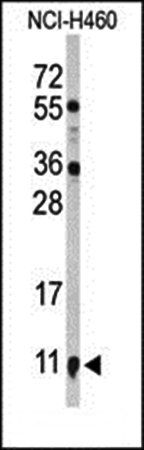 S100A10 antibody