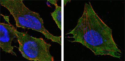 S100A10/P11 Antibody