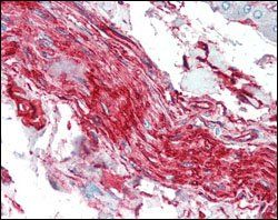 S100A10/P11 Antibody