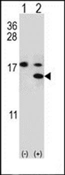 S100A11 antibody