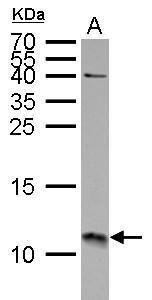 S100 calcium binding protein A11 Antibody