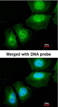 S100A11 antibody