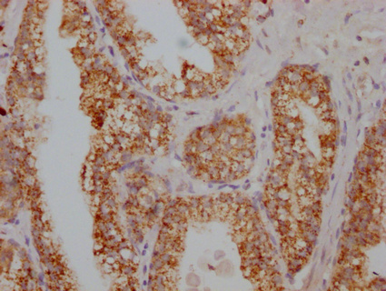 S100A12 antibody