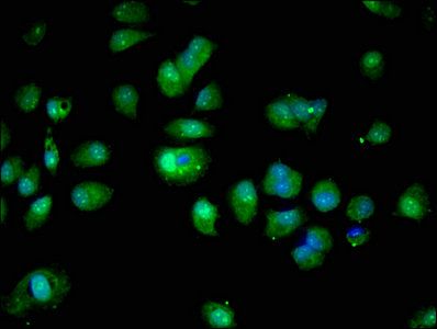 S100A16 Antibody