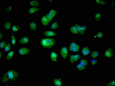 S100A16 antibody