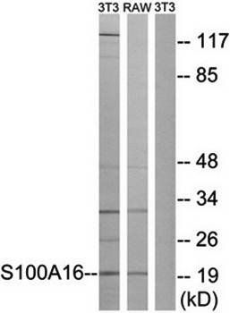 S100A16 Antibody