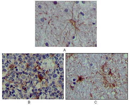 S100A1 Antibody