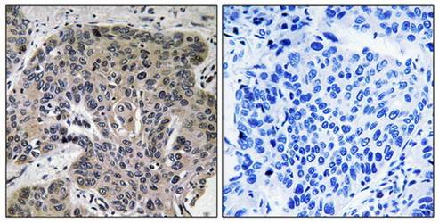 S100A3 antibody