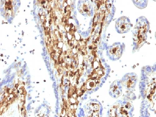 S100A4 antibody