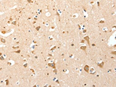 S100A4 Antibody
