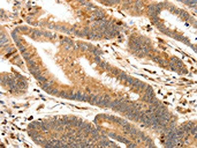 S100A4 Antibody