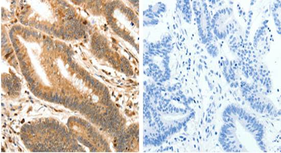 S100A4 Rabbit Polyclonal Antibody