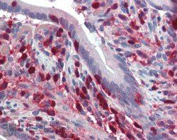 Goat anti-S100A4 / CAPL Antibody