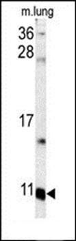 S100A6 antibody