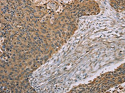 S100A6 Antibody