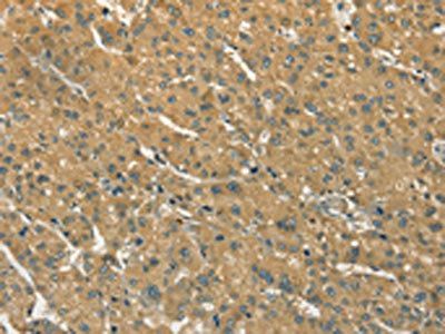 S100A6 Antibody