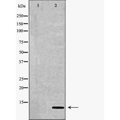 S100B Antibody