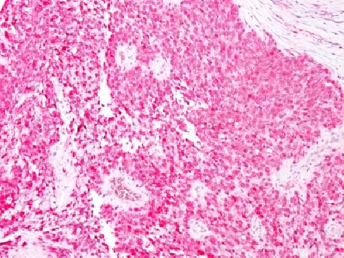 S100B (Astrocyte and Melanoma Marker) Antibody
