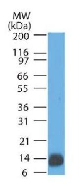 S100B (Astrocyte and Melanoma Marker) Antibody