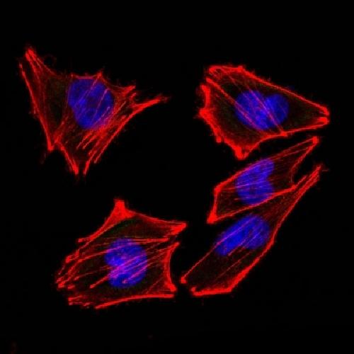 S100B antibody