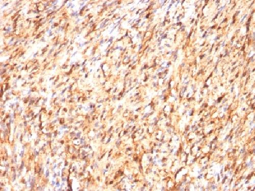 S100B (Astrocyte and Melanoma Marker) Antibody