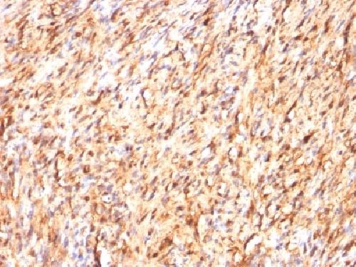 S100B antibody