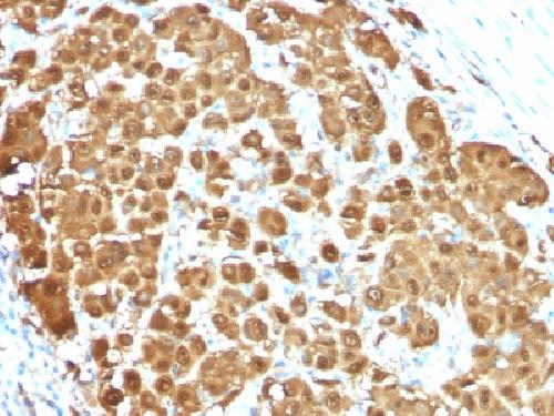 S100B (Astrocyte and Melanoma Marker) Antibody