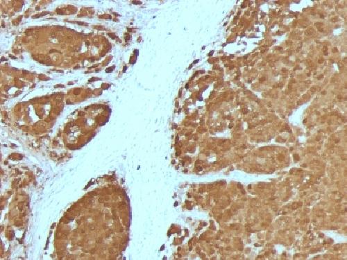 S100B (Astrocyte and Melanoma Marker) Antibody