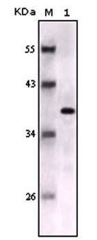 S100B Antibody