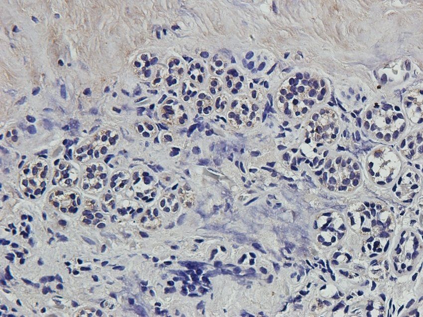 S13A2 antibody