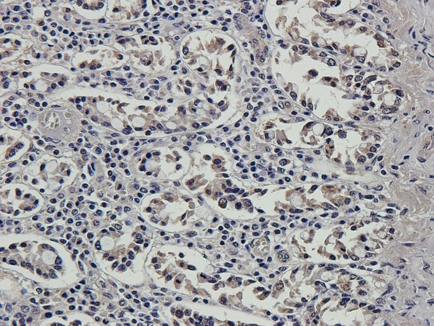 S13A2 antibody