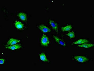 S1PR1 antibody