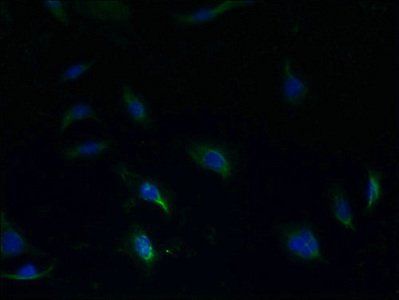 S1PR1 antibody