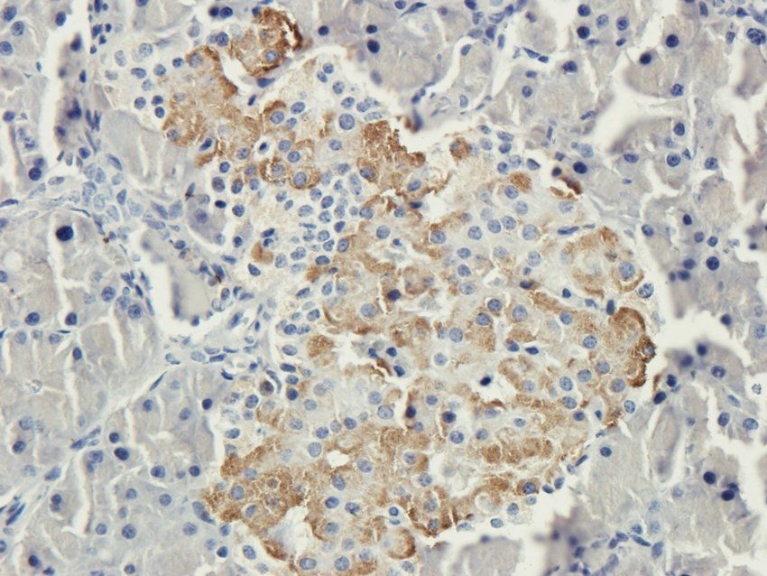 S1PR1 antibody