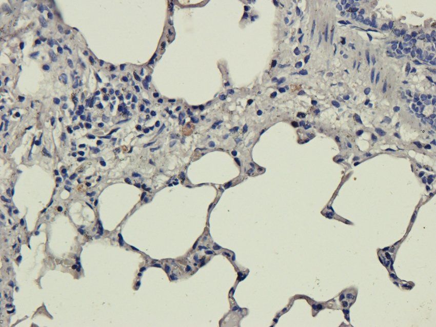 S1PR1 antibody