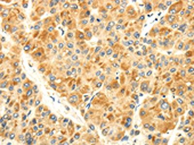 S1PR2 Antibody