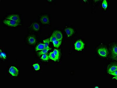 S1PR3 Antibody