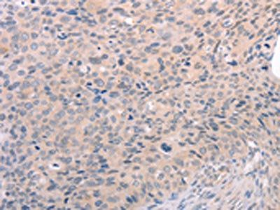 S1PR3 Antibody