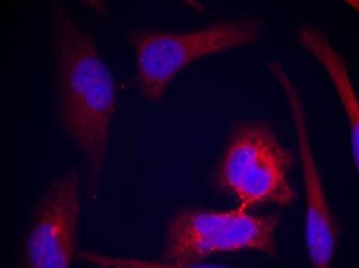 S6 Ribosomal Protein (Phospho-Ser235) Antibody