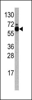 S6K antibody