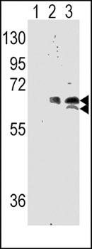 S6K antibody
