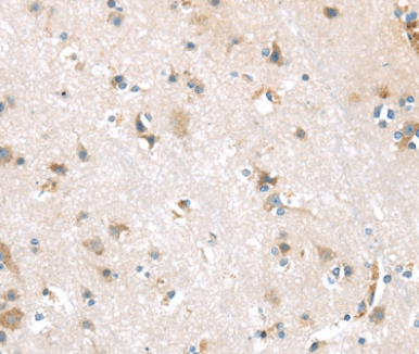 DDK1 Antibody
