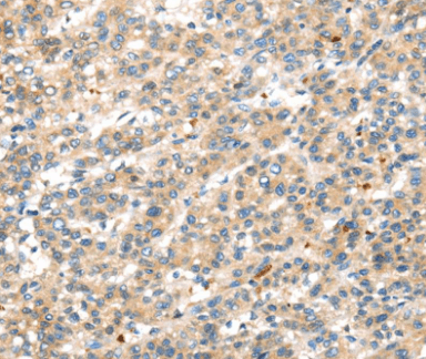 DDK1 Antibody