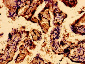 SACS Antibody